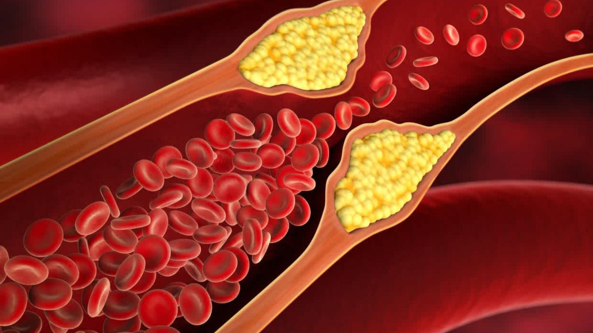 Cholesterol: కొలెస్ట్రాల్ ఎక్కువైతే కనిపించే లక్షణాలు ఇవే..!