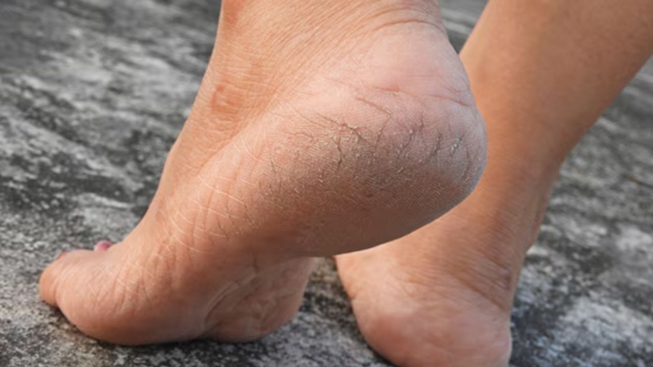 Soft feet Tips: మృదువైన పాదాల కోసం.. ఇలా చేయండి..