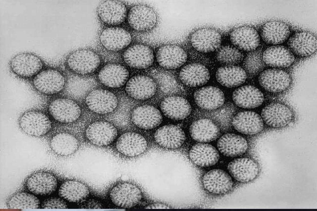 Chiggers (larval mites) bites cause Scrub typhus. (Representative Image / Creative Common)