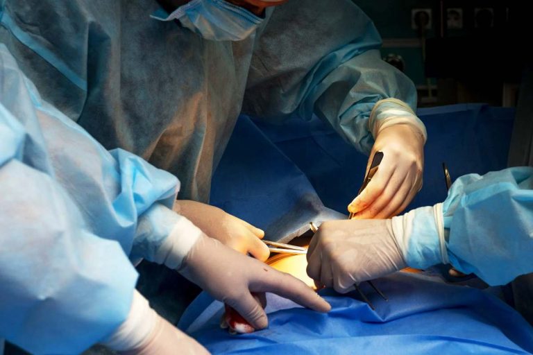 sterilisation surgery
