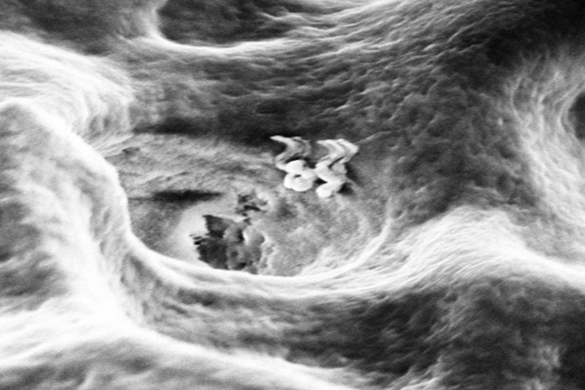 teeth IISc Bengaluru develops nanobots that can enter a dentinal tubule. (Supplied)