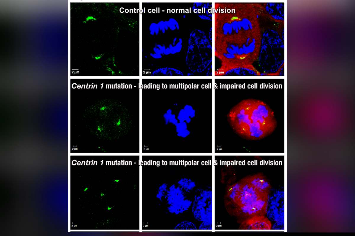 Infertility gene Infertility gene