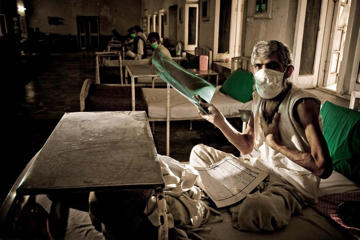 Tuberculosis Tuberculosis