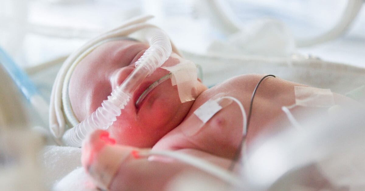 neonatal Representational pic of a baby in Neonatal Intensive Care Unit (N-ICU)