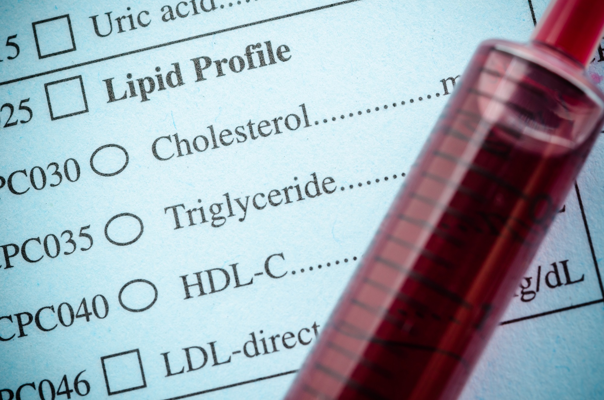 lipid profile1 Do you know how to read your lipid profile report? Why it is important test to keep a check on your heart health