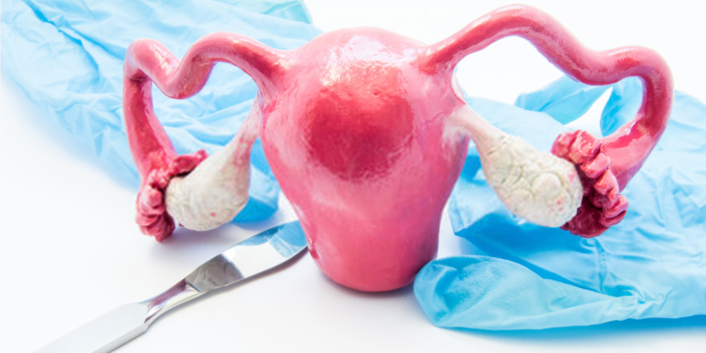 hystrectomy Dr Narendra Gupta and his team have been fighting hard against unnecessary hysterectomies since 2013. (Creative Commons)