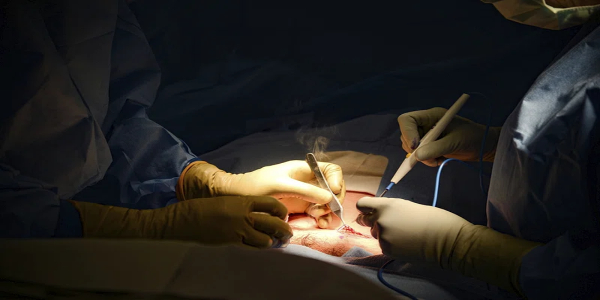 Bengaluru hospital asked to pay ₹1.6 crore Bengaluru hospital told to pay ₹1.6 crore compensation to family for death of patient during C-section surgery