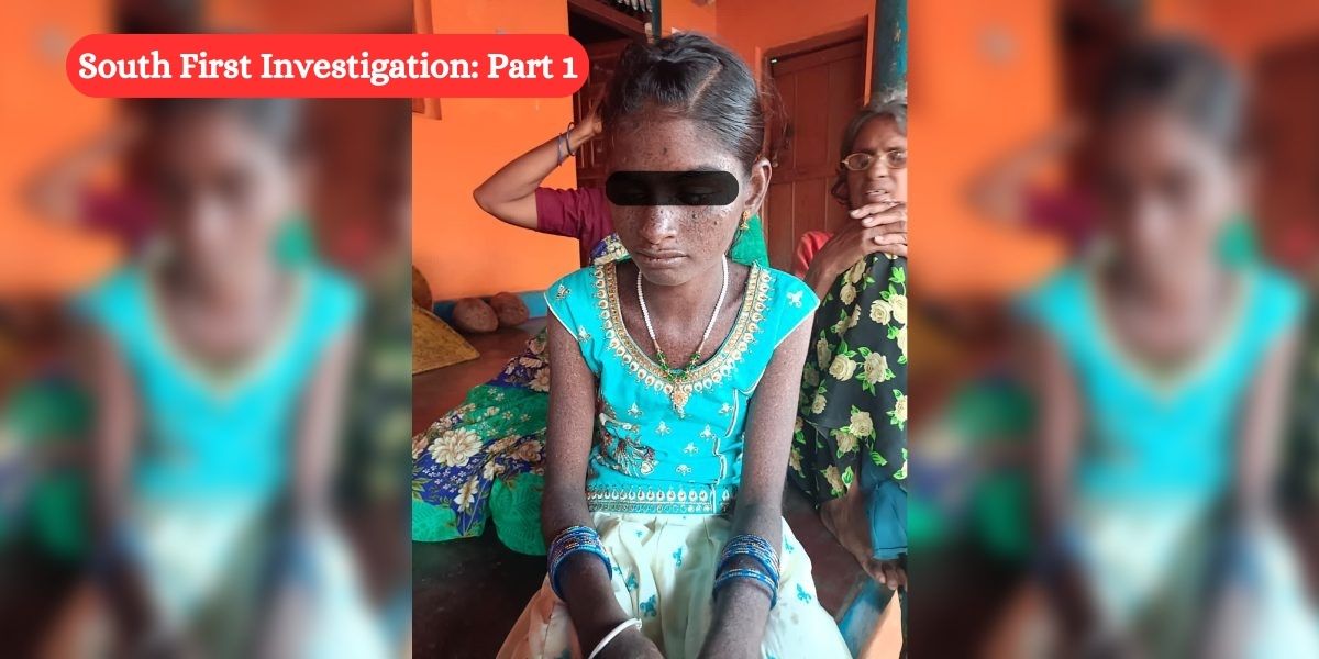 Savitha has three cancers gnawing away at her life. Her parents expect her to have a year or two left to live. (Chetana Belagere/South First) Afflicted with rare genetic condition, children in three Karnataka villages await death in darkness