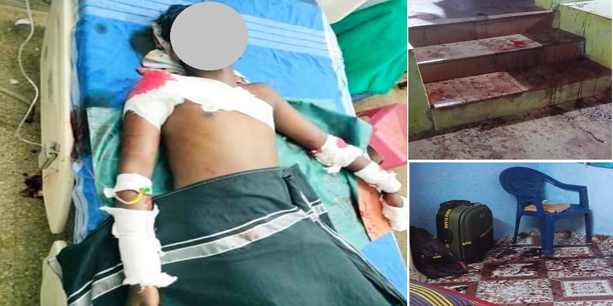 Student 1 Armed with sickles, the gang hacked Chinnadurai, causing injury to his head, hand, and abdomen. Further, the gang attacked his 14-year-old sister too. (Supplied)