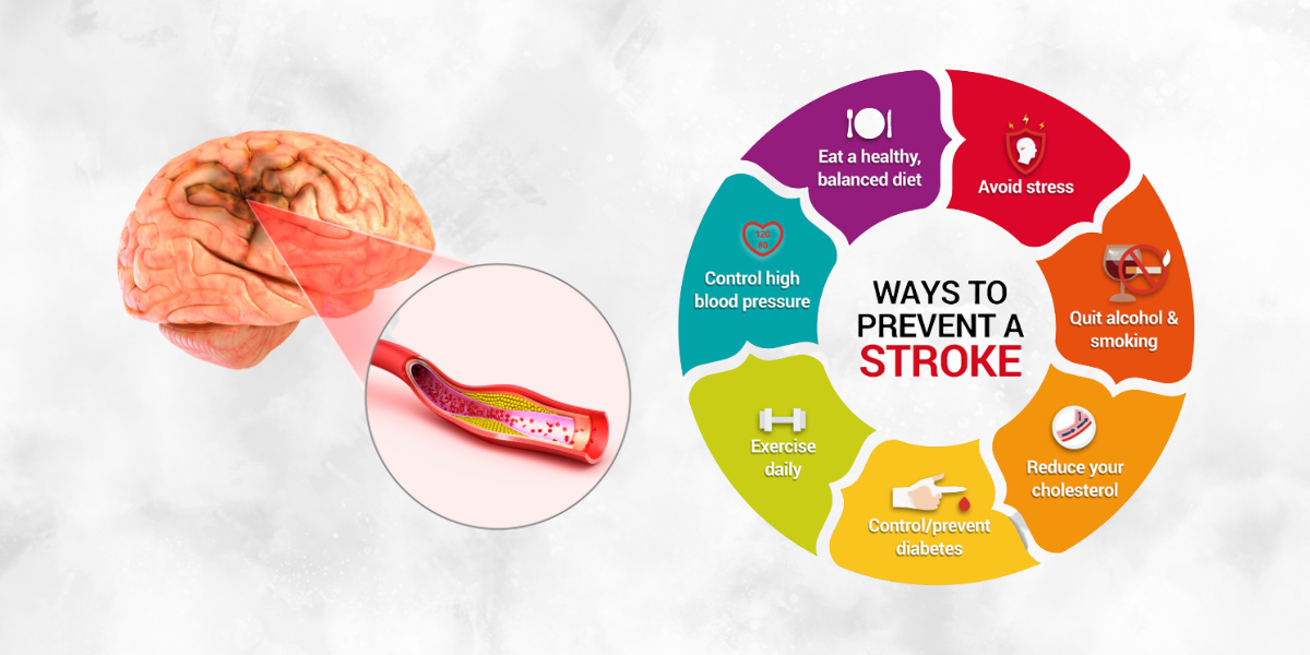 Copy of Untitled (1200 × 600 px) (10) Medication adherence and risk factor monitoring are key aspects of prevention of a new stroke. (Commons/Union Ministry of Health and Family Welfare)