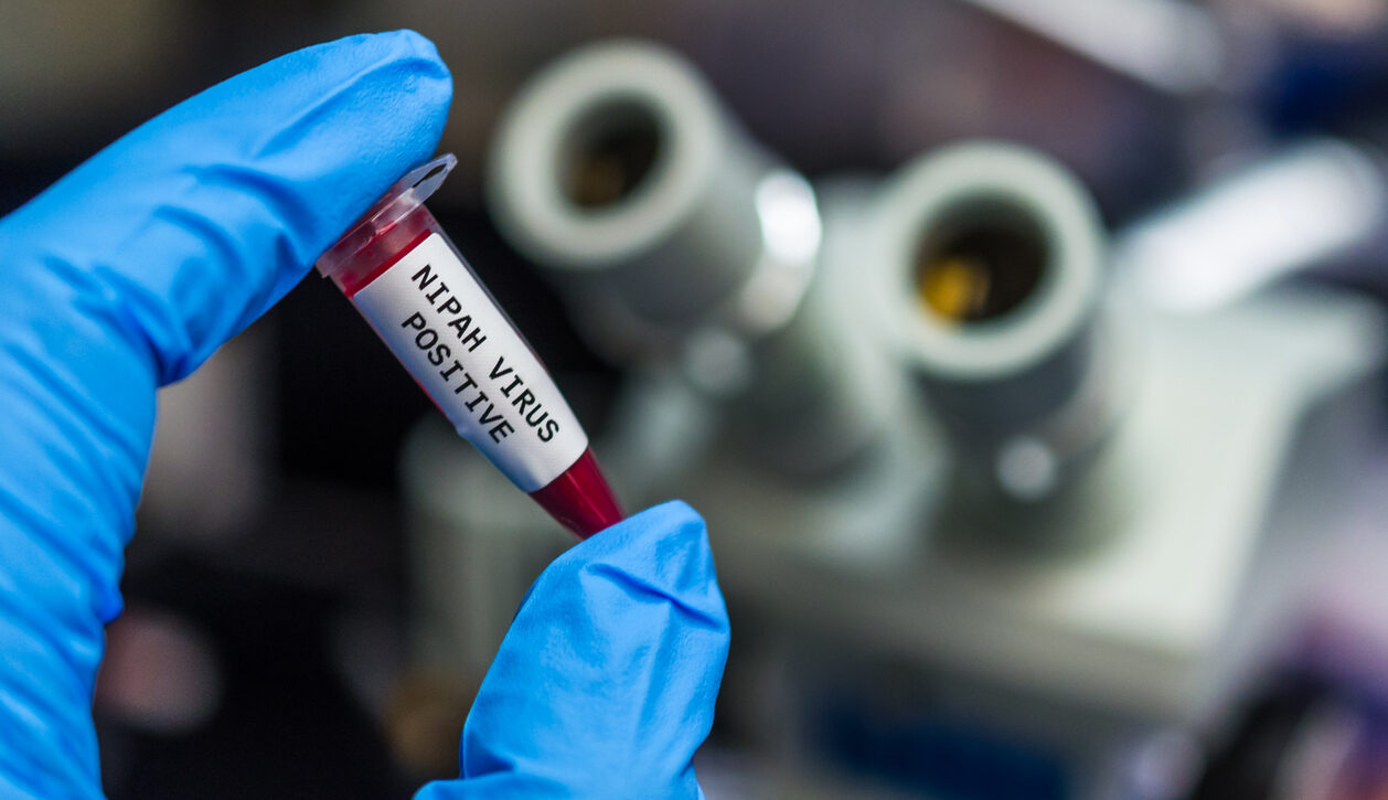 Nipah virus positive blood sample Nipah virus