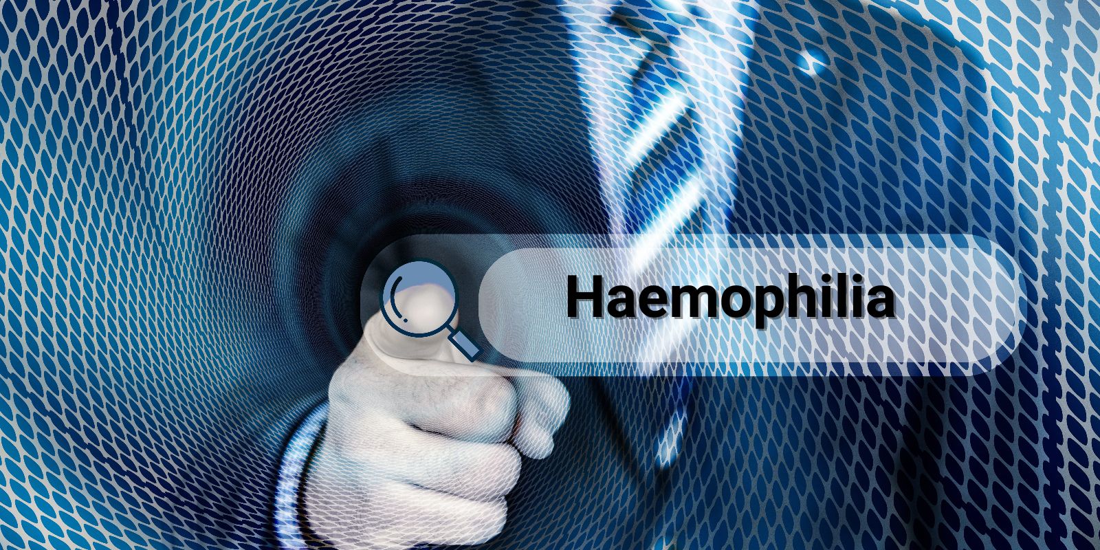 Prophylaxis treatment in haemophilia patients: HHCN comes out with first-of-its-kind Indian guidelines