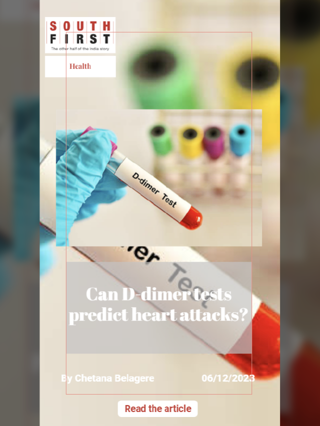 can-d-dimer-tests-predict-heart-attacks-the-south-first