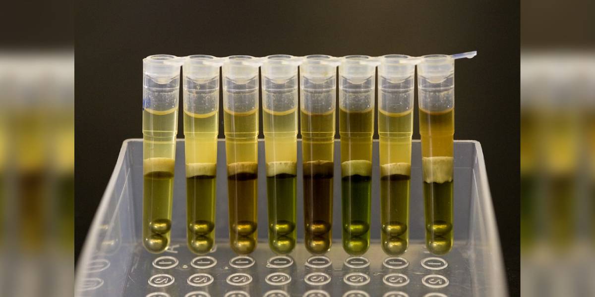 Researchers have discovered that bilirubin reductase is typically found in healthy adults, but it is often absent in newborns and individuals affected by inflammatory bowel disease. (Creative Commons)