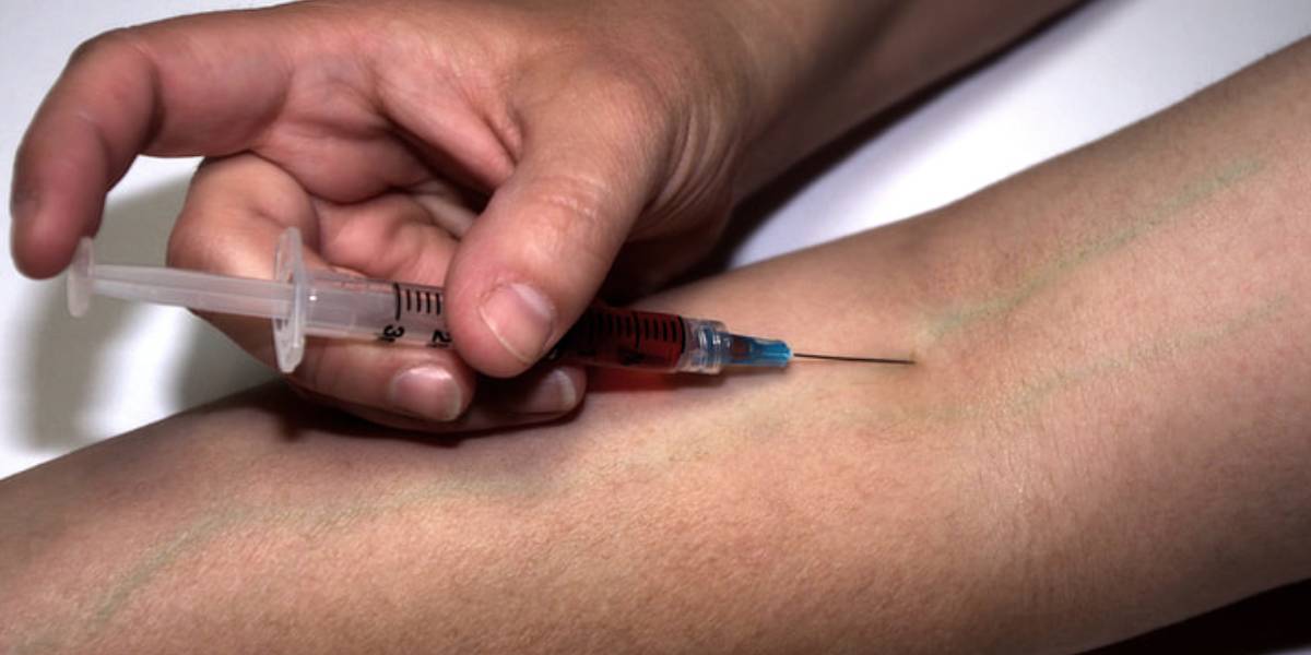 Hyderabad doctor fentanyl The potency of Fentanyl makes it effective in providing relief from intense pain, but it also increases the risk of overdose if not used properly. (Creative Commons)