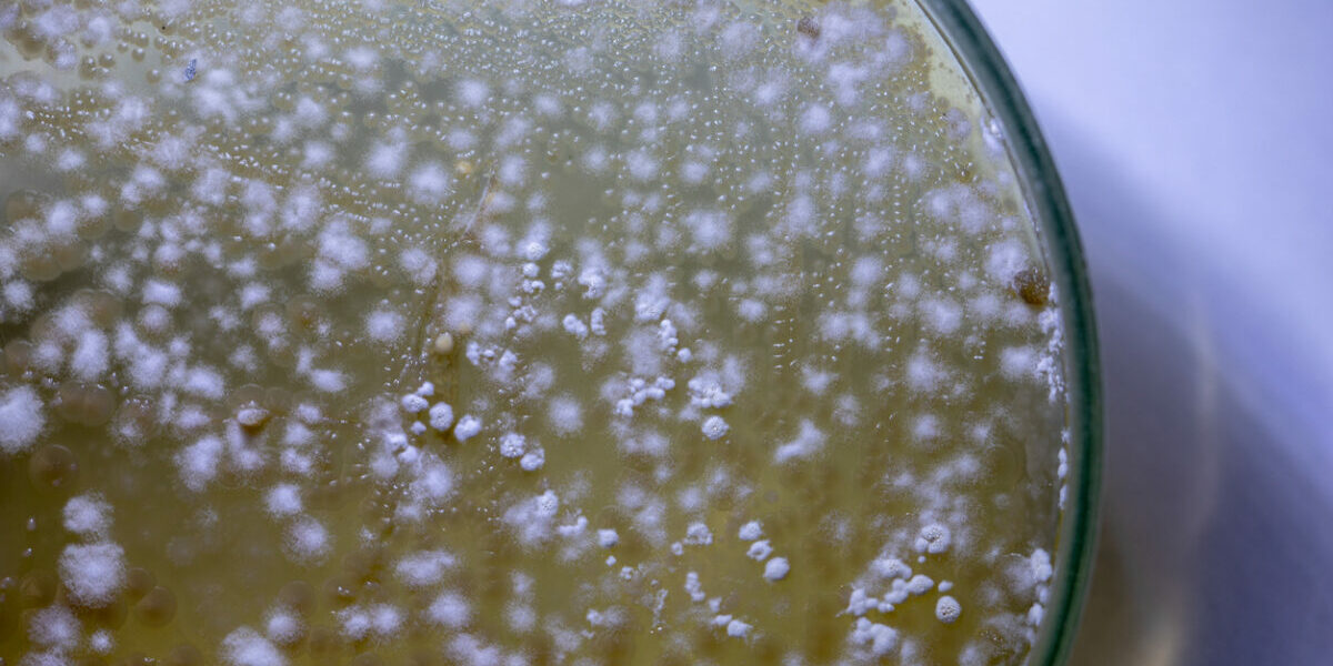 fungal diseases death fungal diseases death