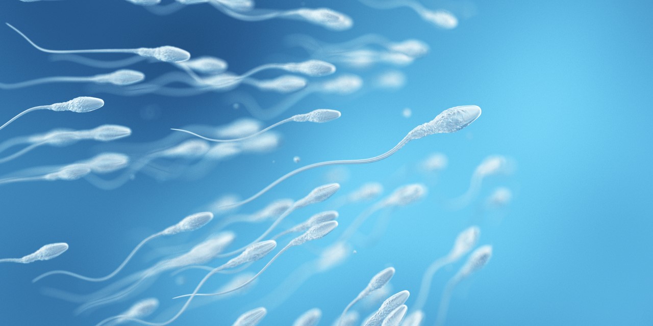 The researchers found that men with severe oligozoospermia were at heightened risk of bone and testicular cancer.