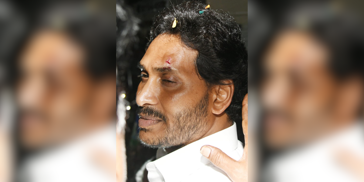 CM Jagan Mohan Reddy with an injury above his left eyebrow. (Sourced) CM Jagan Mohan Reddy with an injury above his left eyebrow. (Sourced)