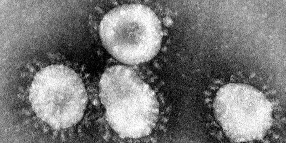 Chandipura vesiculovirus (CHPV) What is Chandipura virus that claimed 16 lives in Gujarat?