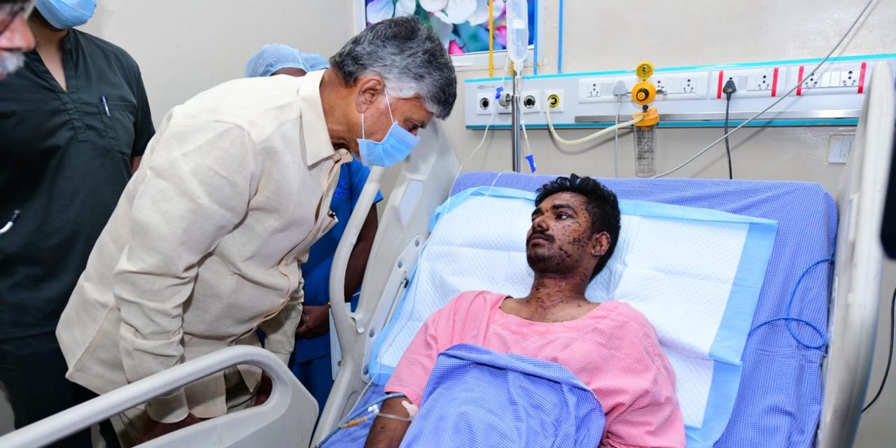 Chandrababu Naidu visiting a person injured in the fire. (X)