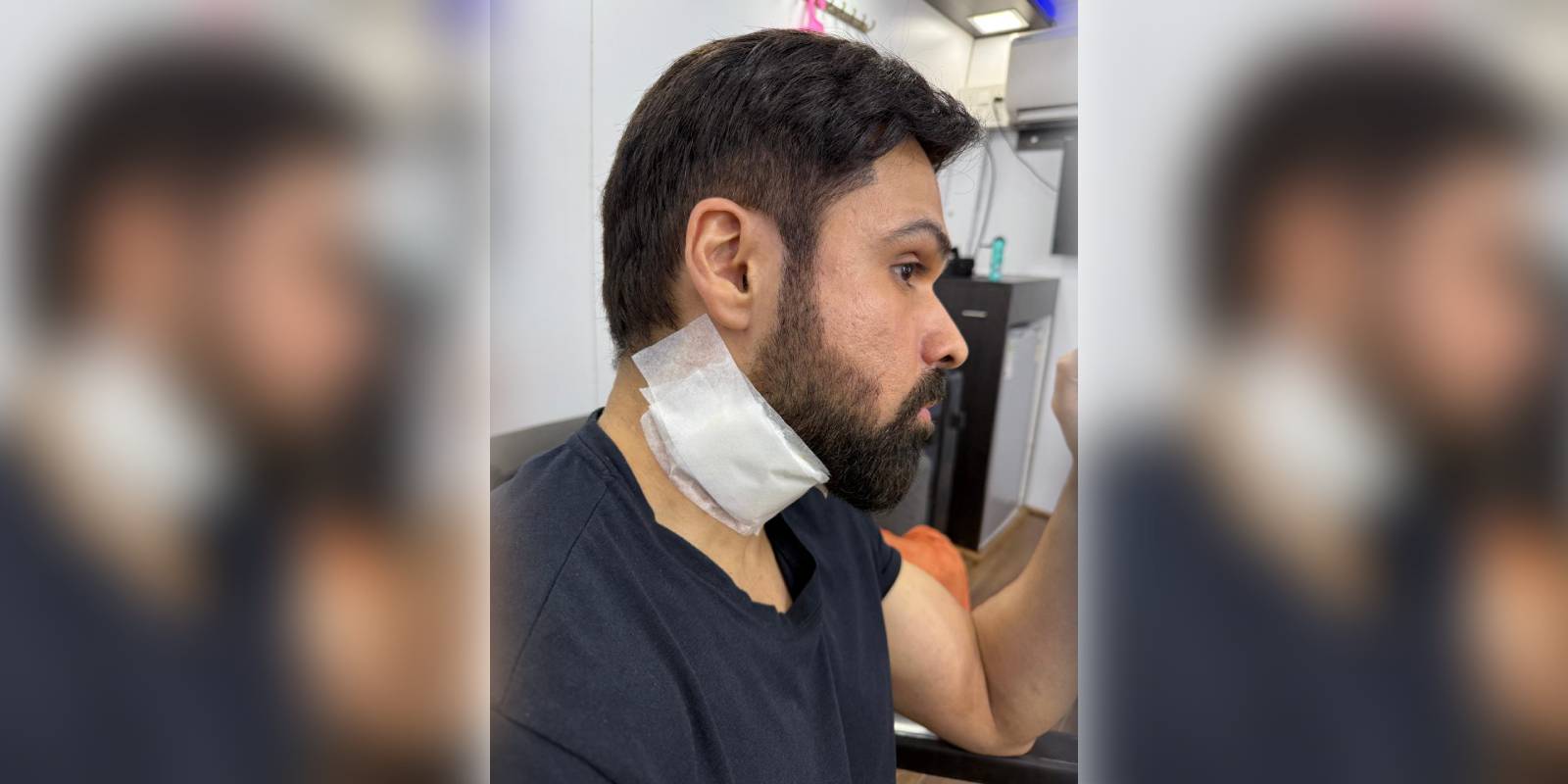 Emraan Hashmi injured on the sets of Goodachari 2