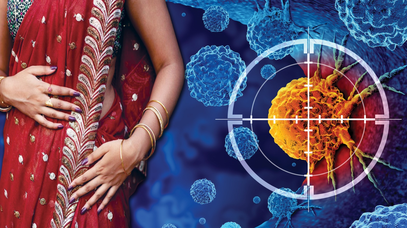 saree cancer Saree Cancer