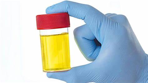 Colour of your urine can tell your health
