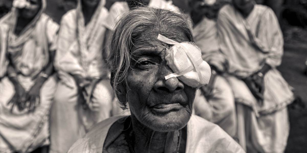 eye surgery Gender gap in spending on Cataract surgery: Men pick costlier lenses, women don’t