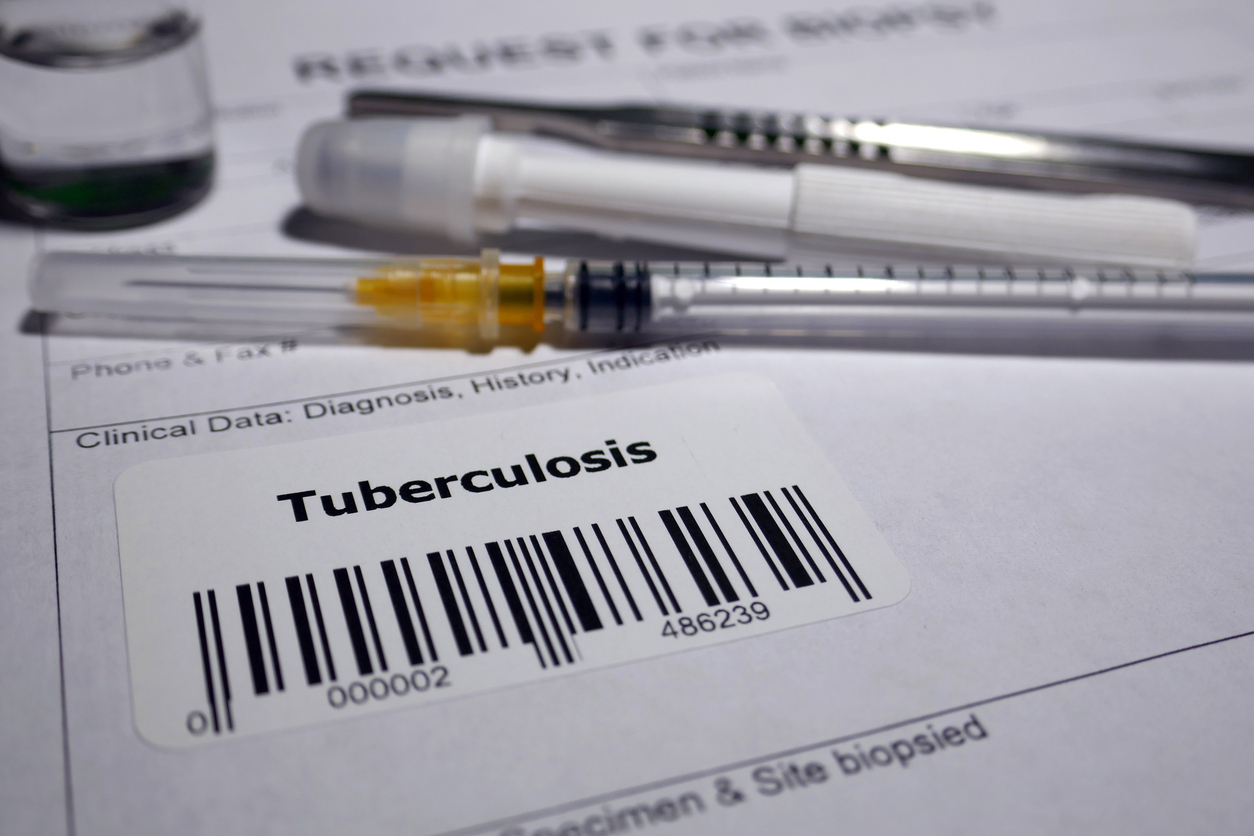 Tuberculosis TB care in India