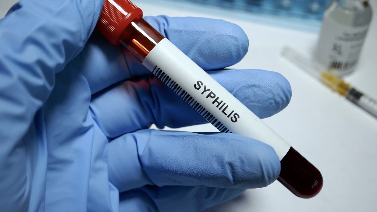 Syphilis surged across Telugu states in ‘21 and ‘22, but was deadlier for men in Andhra