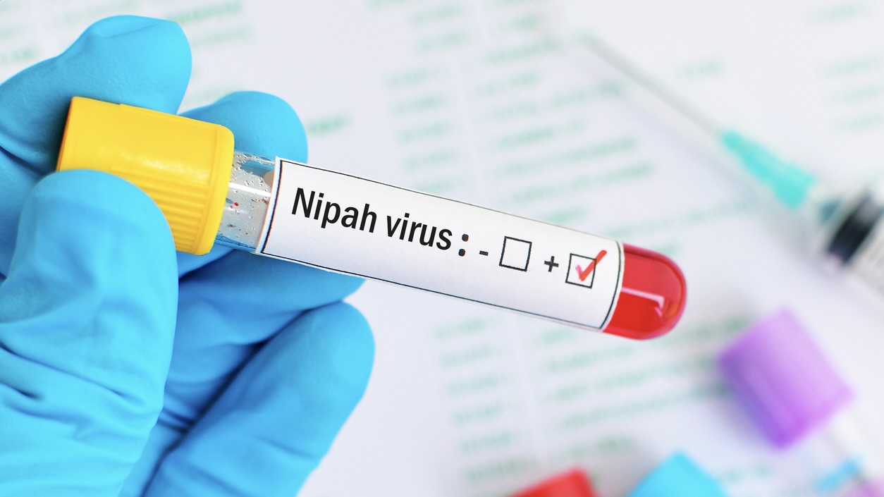 Suspected nipah virus case reported in Palakkad; samples sent for confirmation Suspected nipah virus case reported in Palakkad; samples sent for confirmation