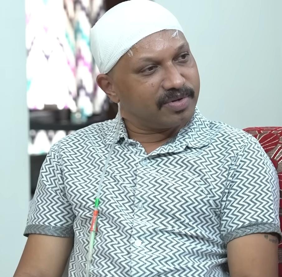 Hair transplant horror: Kerala man battles flesh-eating bacteria following procedure Hair transplant horror: Kerala man battles flesh-eating bacteria following procedure