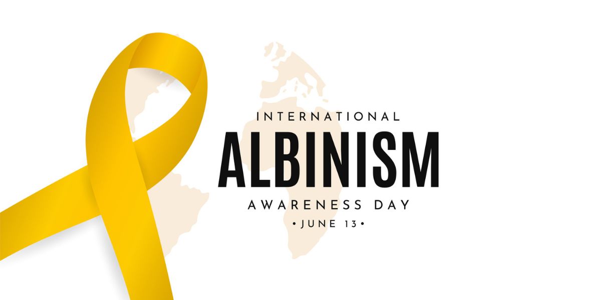 International Albinism Awareness Day. International Albinism Awareness Day.