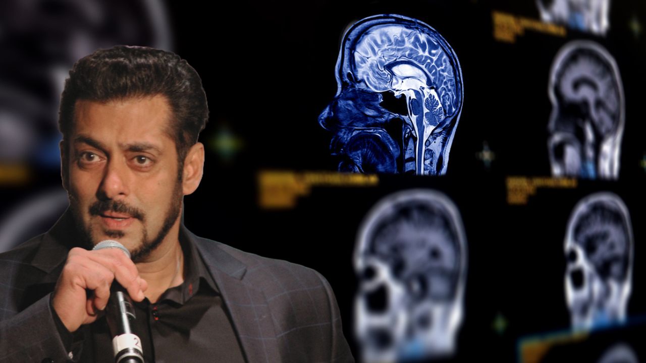 Salman Khan Brain aneurysms: Would most Indians get the same chance at early detection as Salman Khan?