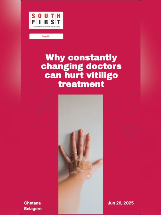 Why constantly changing doctors can hurt vitiligo treatment