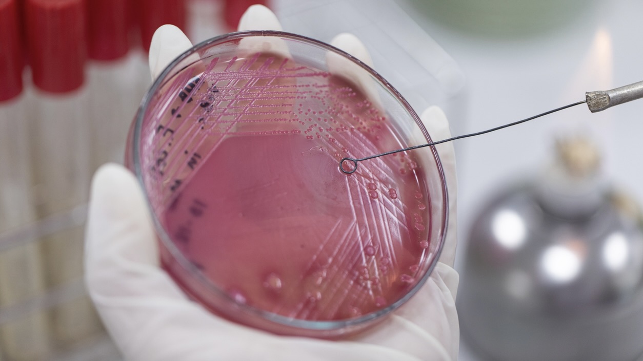 Scientists at CCMB Hyderabad find how bacteria fix faulty cell walls, a clue that may lead to new antibiotics