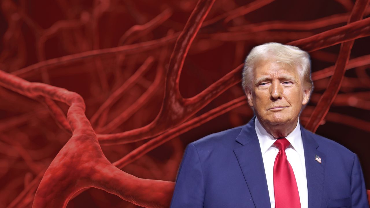 Chronic venous insufficiency: Trump’s diagnosis a wake-up call for India’s ageing population
