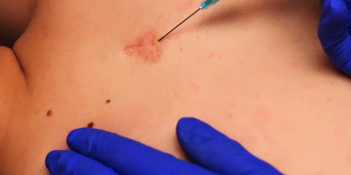 India cosmetic surgery