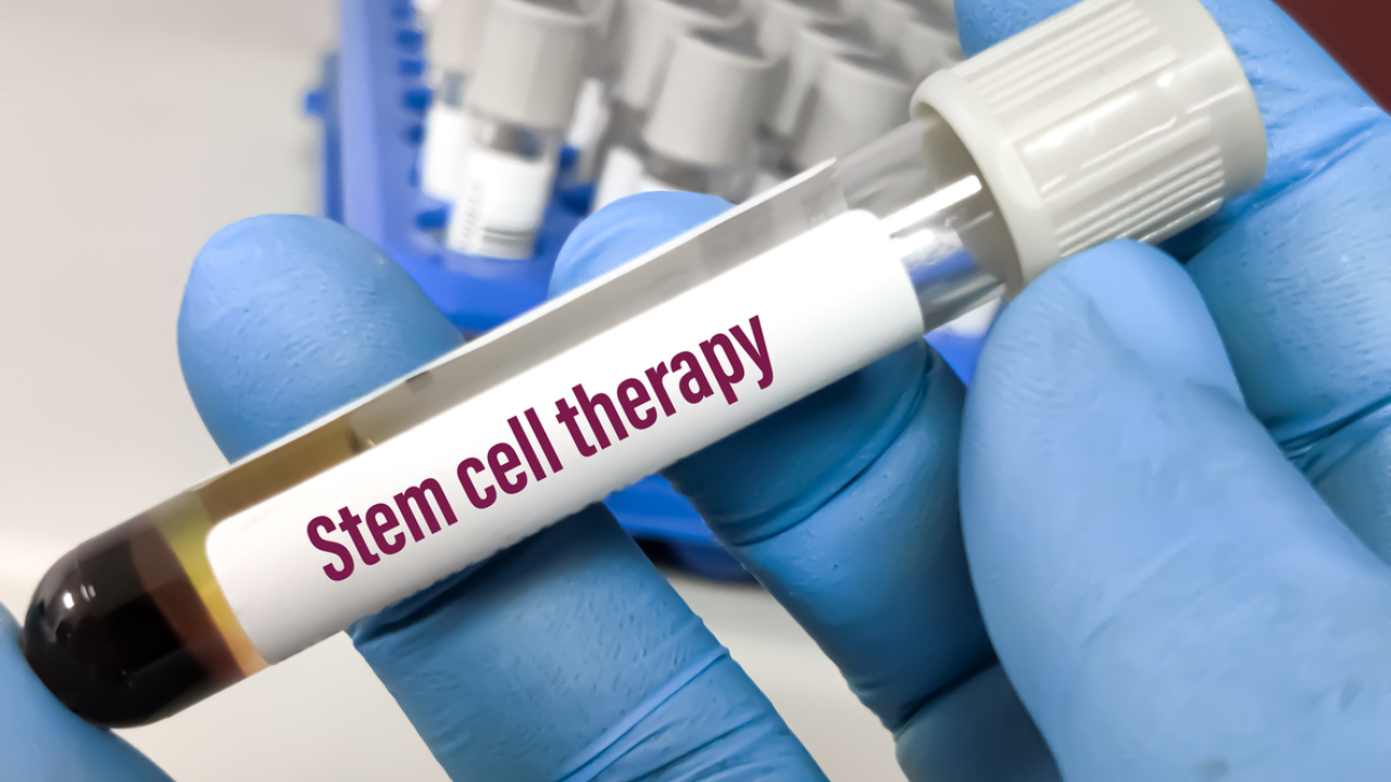 stem cell Representational image. Credit: iStock