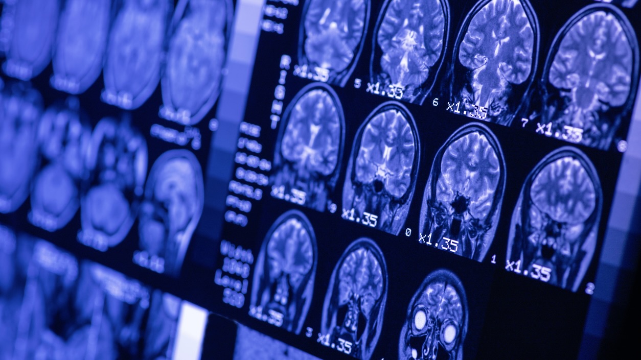 9DF82B32-B904-43A7-BF12-3FC5A64C0FBF_1_201_a Supreme Court rejects challenge to brain-stem death definition, urges expert review