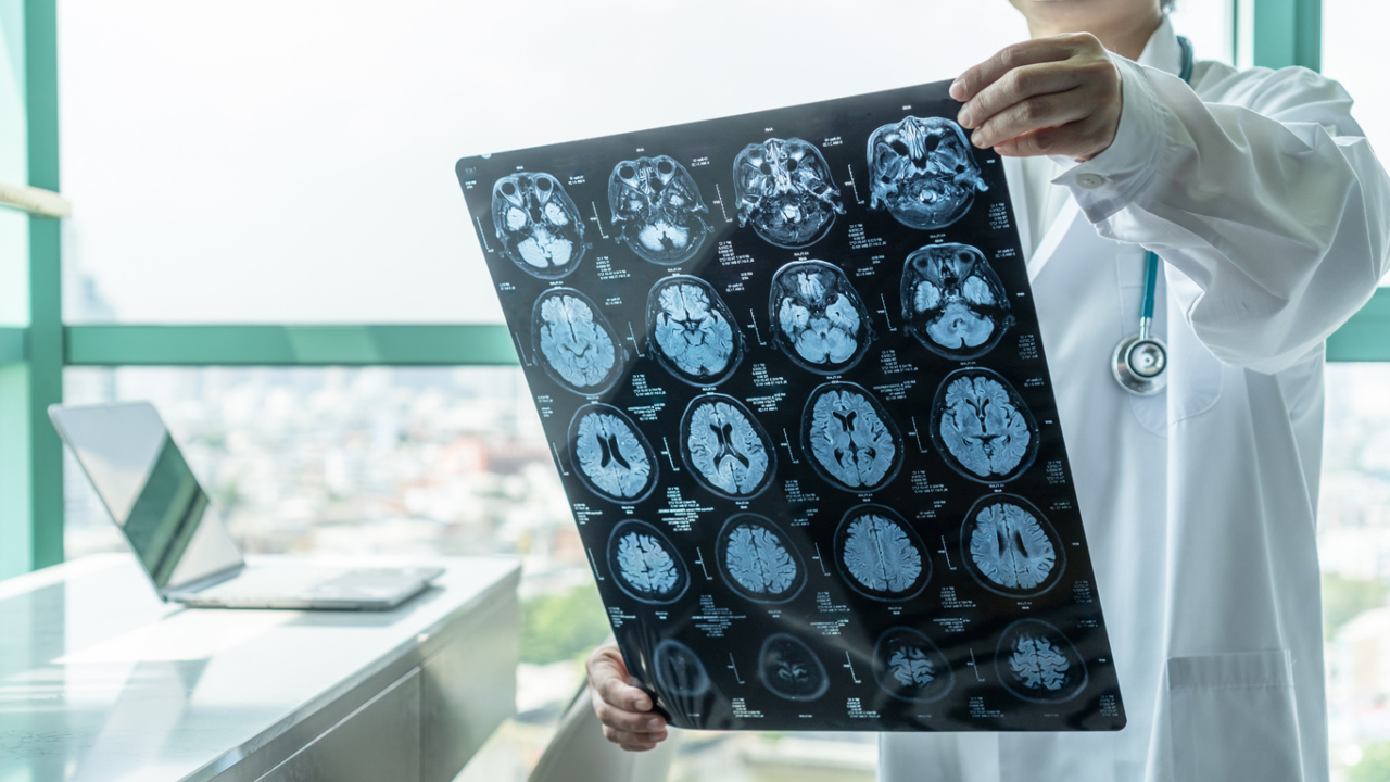Chennai hospital performs hybrid neurosurgery Representational image. Credit: iStock
