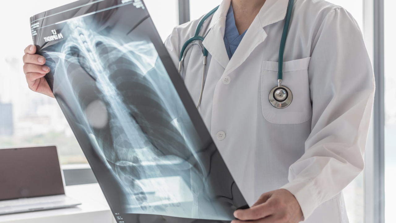 Representative image. Credit: iStock