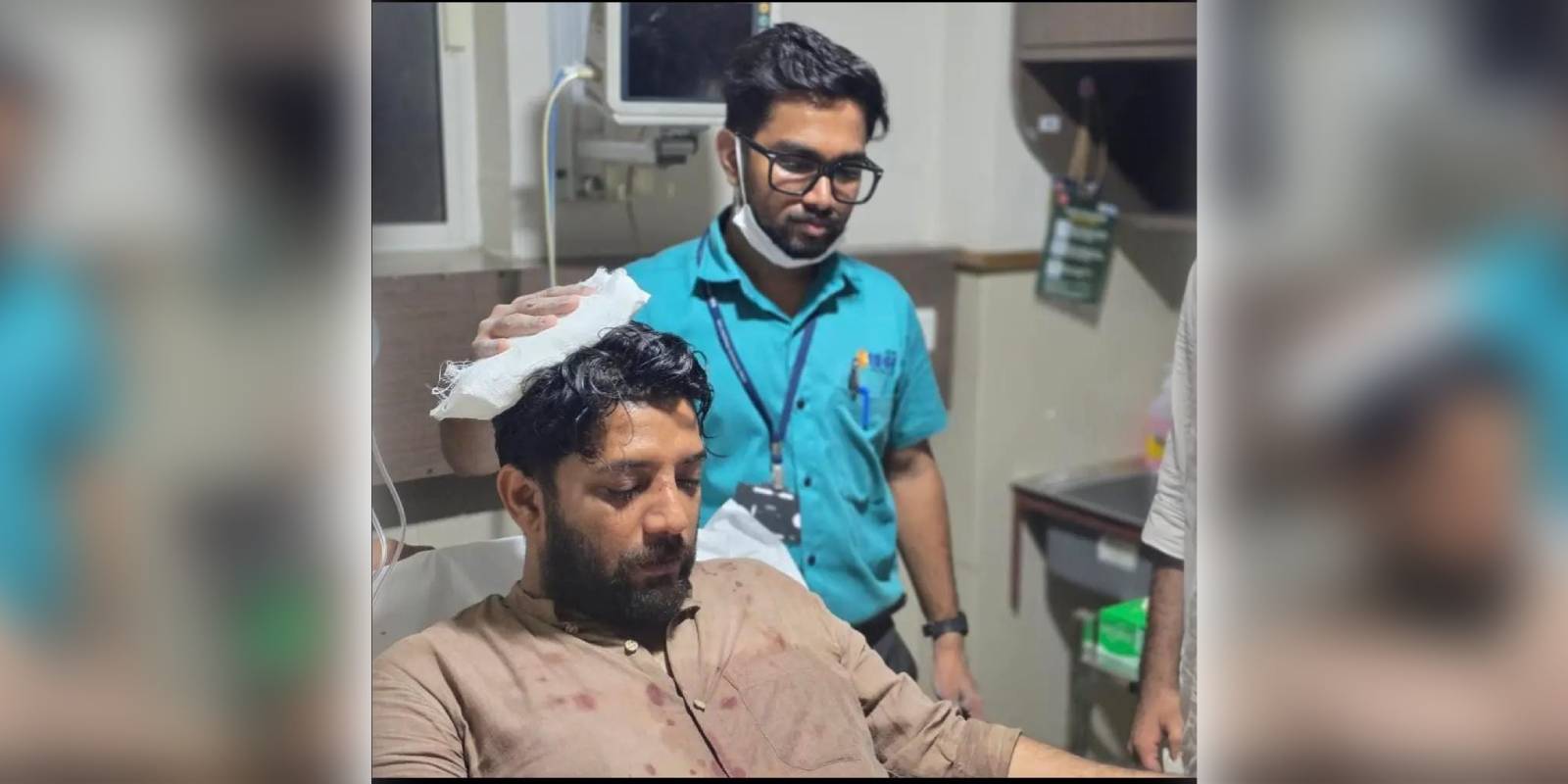 Shafi Parambil sustains nasal bone fractures