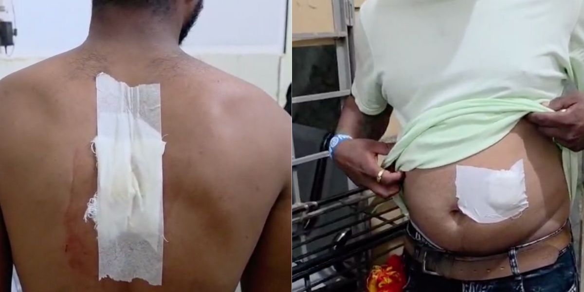 Five people were stabbed by unknown miscreants during Kannada Rajyotsava celebrations in Belagavi