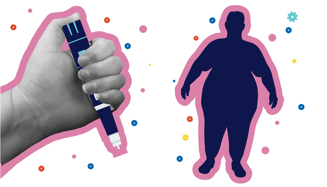 Link between obesity, insulin resistance, and hair loss