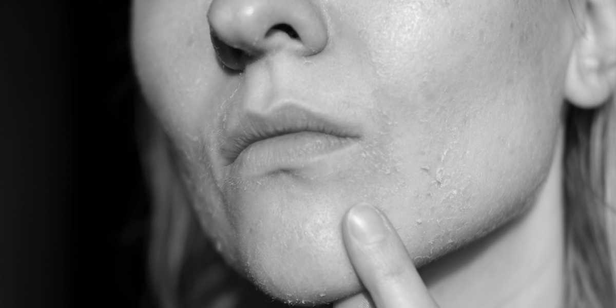 How stress worsens ageing — and why timing matters: Experts weigh in at Dakshin Health Summit