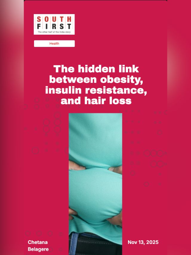 The hidden link between obesity, insulin resistance, and hair loss