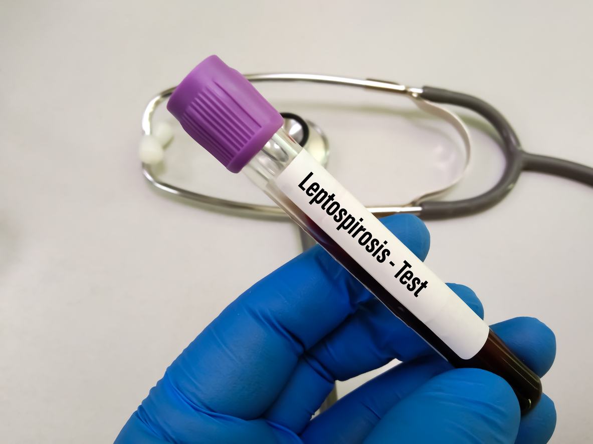 Blood sample tube for Leptospirosis test at medical laboratory. Credit: iStock