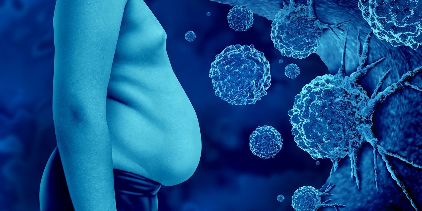 Obesity and cancer. (iStock)