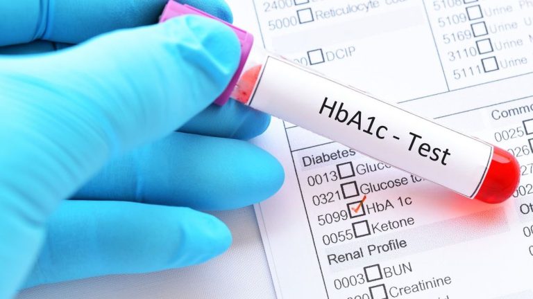 HbA1c test for diabetes diagnosis. (iStock)